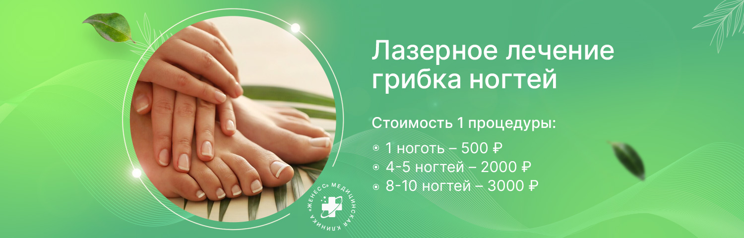 Лазерное лечение грибка ногтей